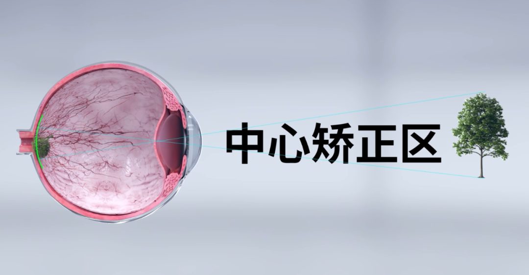 首页- Z6官网中国区人生就是博